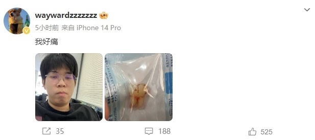 【QY球友会】NIP下路有点变态了！大黄分享刚拔的智齿，Zhuo与Photic留言好大/想要~