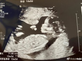 【QY球友会】?Doinb官宣升级当爸爸:老婆和宝宝给我带来非常多前进的动力